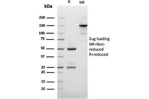 SDS-PAGE Analysis Purified Filaggrin Mouse Recombinant Monoclonal Antibody (rFLG/1561). (Recombinant Filaggrin 抗体  (AA 198-288))
