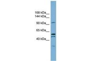 Image no. 1 for anti-Anoctamin 6 (ANO6) (AA 791-840) antibody (ABIN6743329) (Anoctamin 6 抗体  (AA 791-840))