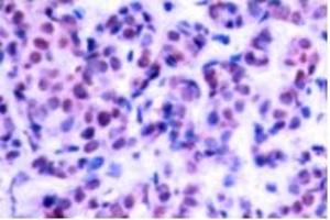 Image no. 1 for anti-Jun D Proto-Oncogene (JUND) (pSer255) antibody (ABIN318059) (JunD 抗体  (pSer255))