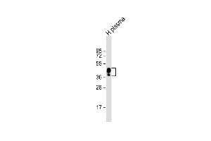 Anti-HPR Antibody (Center) at 1:2000 dilution + human plasma lysate Lysates/proteins at 20 μg per lane. (HPR 抗体  (AA 212-240))
