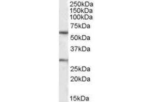 EB09214 (1µg/ml) staining of Human Heart lysate (35µg protein in RIPA buffer).