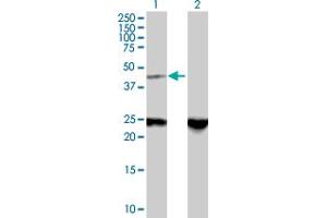 Western Blot analysis of ZNF24 expression in transfected 293T cell line by ZNF24 MaxPab polyclonal antibody. (ZNF24 抗体  (AA 1-368))