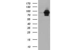 Western Blotting (WB) image for anti-Aldehyde Dehydrogenase 1 Family, Member L1 (ALDH1L1) antibody (ABIN1496582) (ALDH1L1 抗体)