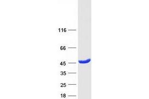 Western Blotting (WB) image for Guanosine Monophosphate Reductase 2 (GMPR2) (Transcript Variant 3) protein (Myc-DYKDDDDK Tag) (ABIN2722090)