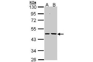 WB Image Sample (30 ug of whole cell lysate) A: H1299 B: Hela 10% SDS PAGE antibody diluted at 1:1000 (EPHX1 抗体)