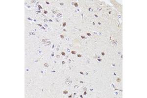 Immunohistochemistry of paraffin-embedded rat brain using DMAP1 antibody (ABIN4903487) at dilution of 1:100 (40x lens). (DMAP1 抗体)