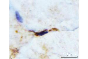 IHC analysis of M Cadherin/CDH15 using anti-M Cadherin/CDH15 antibody (ABIN7602173). (CDH15 抗体  (AA 61-742))