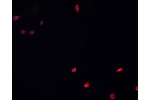 ABIN6266753 staining HeLa  cells by IF/ICC. (MUTYH 抗体  (Internal Region))