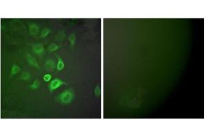 Immunofluorescence analysis of A549 cells, using S100 A1 antibody (ABIN5976502). (S100A1 抗体  (N-Term))