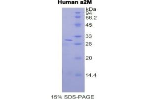 SDS-PAGE of Protein Standard from the Kit (Highly purified E. (alpha 2 Macroglobulin CLIA Kit)