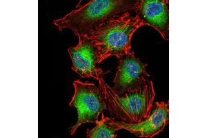 Immunocytochemistry (ICC) image for anti-3-phosphoinositide Dependent Protein Kinase-1 (PDPK1) (AA 457-556) antibody (ABIN5855659) (PDPK1 抗体  (AA 457-556))