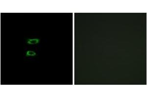 Immunofluorescence analysis of A549 cells, using BMP8A Antibody. (BMP8A 抗体  (AA 253-302))