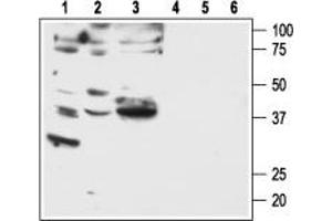 Western blot analysis of human breast adenocarcinoma MDA-MB-231 (lanes 1 and 4) and MDA-MB-468 (lanes 2 and 5), and human lung small cell carcinoma NCI-H526 (lanes 3 and 6) cell lines: - 1-3. (F2RL1 抗体  (C-Term, Intracellular))