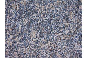 Image no. 5 for anti-ADP-Ribosylation Factor GTPase Activating Protein 1 (ARFGAP1) antibody (ABIN1496679)