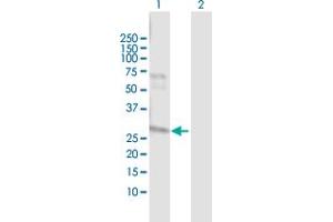 Western Blot analysis of NAT2 expression in transfected 293T cell line by NAT2 MaxPab polyclonal antibody. (NAT2 抗体  (AA 1-290))