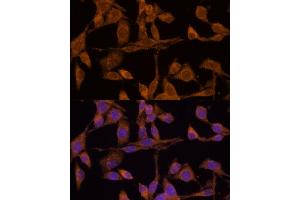 Immunofluorescence analysis of HeLa cells using USP15 Polyclonal Antibody (ABIN6130759, ABIN6149998, ABIN6149999 and ABIN6222530) at dilution of 1:100 (40x lens). (USP15 抗体  (AA 852-952))