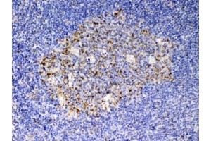 Immunohistochemistry (IHC) image for anti-KIT Ligand (KITLG) antibody (ABIN5647180)