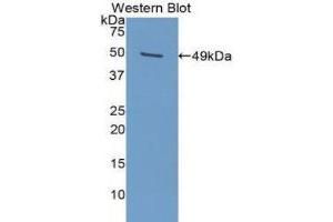 Western Blotting (WB) image for anti-Plasminogen Activator Inhibitor 1 (SERPINE1) (AA 25-402) antibody (ABIN1078449) (PAI1 抗体  (AA 25-402))