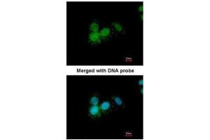ICC/IF Image Immunofluorescence analysis of paraformaldehyde-fixed A549, using Progesterone receptor, antibody at 1:200 dilution. (Progesterone Receptor 抗体  (N-Term))