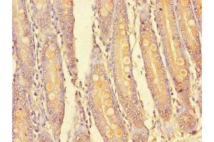 Immunohistochemistry of paraffin-embedded human small intestine tissue using ABIN7169145 at dilution of 1:100 (PIM2 抗体  (AA 1-210))