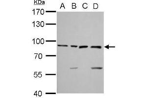 WB Image Ku80 antibody [N3C2], Internal detects XRCC5 protein by Western blot analysis. (X-Ray Repair Cross Complementing 5 抗体)