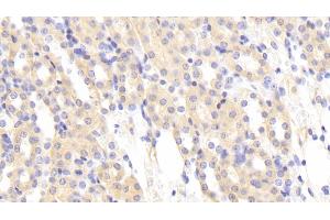 Detection of MASP1 in Mouse Kidney Tissue using Polyclonal Antibody to Mannose Associated Serine Protease 1 (MASP1) (MASP1 抗体  (AA 25-453))