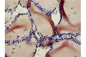 Immunohistochemistry (IHC) image for anti-RanBP-Type and C3HC4-Type Zinc Finger Containing 1 (RBCK1) (AA 162-261) antibody (ABIN7167100)