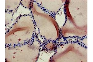 Immunohistochemistry of paraffin-embedded human thyroid tissue using ABIN7167100 at dilution of 1:100 (RBCK1 抗体  (AA 162-261))