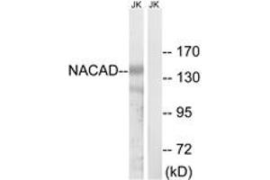 Western blot analysis of extracts from Jurkat cells, using NACAD Antibody. (NACAD 抗体  (AA 376-425))