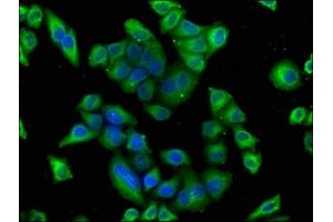 Immunofluorescence staining of Hela cells with ABIN7164063 at 1:100, counter-stained with DAPI.