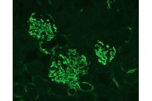 C3 protein fragments deposited on kidney cells of MPL-lpr mouse. (C3 抗体)