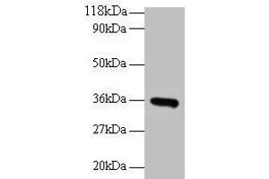 Western blot All lanes: CYC1 antibody at 2 μg/mL + EC109 whole cell lysate Secondary Goat polyclonal to rabbit IgG at 1/15000 dilution Predicted band size: 36 kDa Observed band size: 36 kDa (Cytochrome C1 抗体  (AA 85-325))