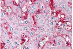 Human Liver (formalin-fixed, paraffin-embedded) stained with B2M antibody ABIN239806 at 5 ug/ml followed by biotinylated anti-mouse IgG secondary antibody ABIN481714, alkaline phosphatase-streptavidin and chromogen. (beta-2 Microglobulin 抗体)
