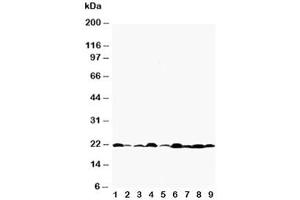 Western blot testing of Bax antibody and Lane 1:  rat testis (BAX 抗体  (AA 19-33))