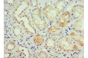 Immunohistochemistry (IHC) image for anti-Potassium Intermediate/small Conductance Calcium-Activated Channel, Subfamily N, Member 4 (KCNN4) (AA 288-427) antibody (ABIN7156944)