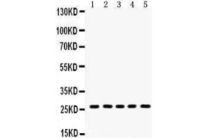 Western Blotting (WB) image for anti-Hydroxysteroid (17-Beta) Dehydrogenase 10 (HSD17B10) (AA 48-261) antibody (ABIN3042460)