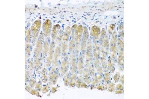 Immunohistochemistry of paraffin-embedded mouse stomach using TAMM41 antibody at dilution of 1:100 (x40 lens). (TAM41 抗体)