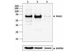 Western Blotting (WB) image for anti-Recombination Activating Gene 2 (RAG2) antibody (ABIN2666293) (RAG2 抗体)