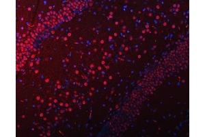 IF analysis of SNRPN using anti-SNRPN antibody (ABIN3043934).
