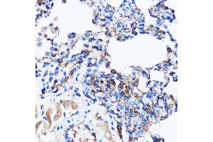 Immunohistochemistry of paraffin-embedded Rat lung using p38 MAPK Rabbit pAb (ABIN7268615) at dilution of 1:100 (40x lens). (MAPK14 抗体  (AA 1-360))