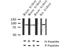 Western blot analysis of Phospho-Tau (Ser404) expression in various lysates (MAPT 抗体  (pSer404))