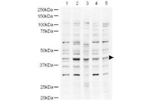 Image no. 1 for anti-Ubiquitin Specific Peptidase 18 (USP18) (AA 40-49) antibody (ABIN401252) (USP18 抗体  (AA 40-49))