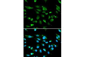 Immunofluorescence analysis of A549 cell using AIRE antibody. (AIRE 抗体  (AA 30-130))