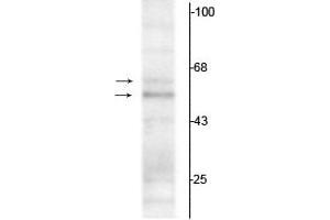 Western Blotting (WB) image for anti-Thyroid Hormone Receptor, alpha (THRA) (N-Term) antibody (ABIN361383)