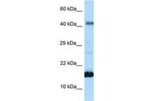 Image no. 1 for anti-Somatostatin (SST) (AA 35-84) antibody (ABIN6748033) (Somatostatin 抗体  (AA 35-84))