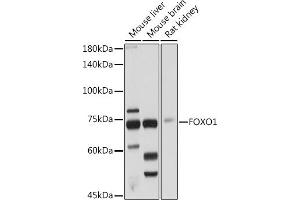 Western blot analysis of extracts of various cell lines, using FOXO1 antibody (ABIN3017007, ABIN3017008, ABIN3017009 and ABIN6219920) at 1:1000 dilution.