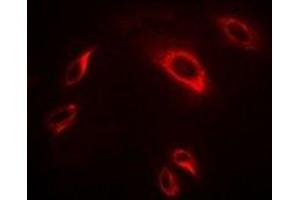 Immunofluorescent analysis of TRAF2 staining in Hela cells. (TRAF2 抗体)