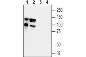Western blot analysis of mouse (lanes 1 and 3) and rat (lanes 2 and 4) brain lysates: - 1,2. (DLGAP1 抗体  (Intracellular))