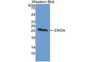 Western Blotting (WB) image for anti-Fast Skeletal Troponin I (TNNI2) (AA 1-182) antibody (ABIN1860816) (TNNI2 抗体  (AA 1-182))