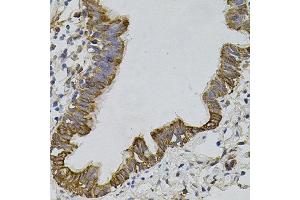 Immunohistochemistry of paraffin-embedded human lung using ARHGEF11 antibody. (ARHGEF11 抗体)